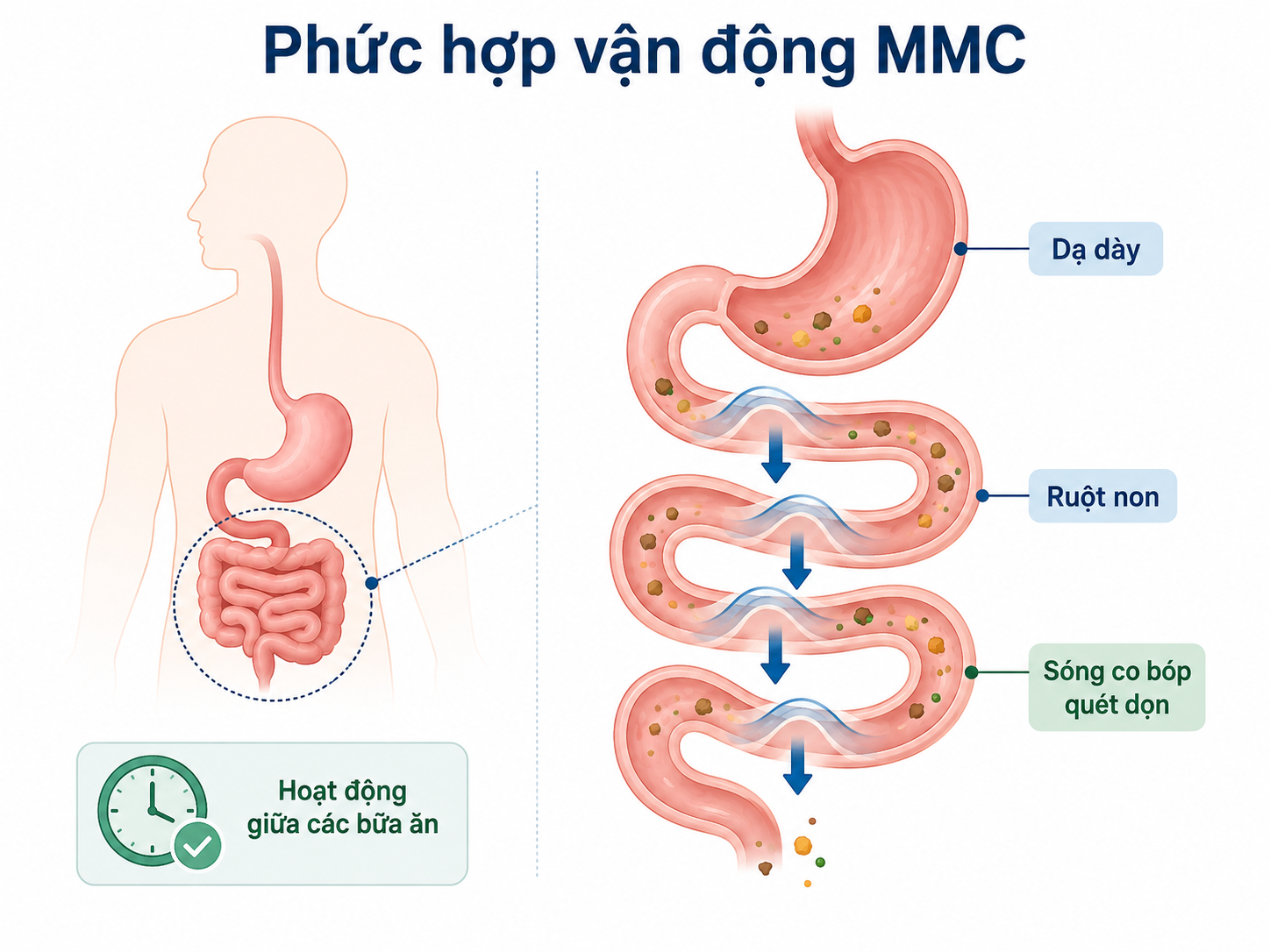 Phức hợp vận động MMC giúp đẩy thức ăn còn sót và chất cặn xuống đường tiêu hóa