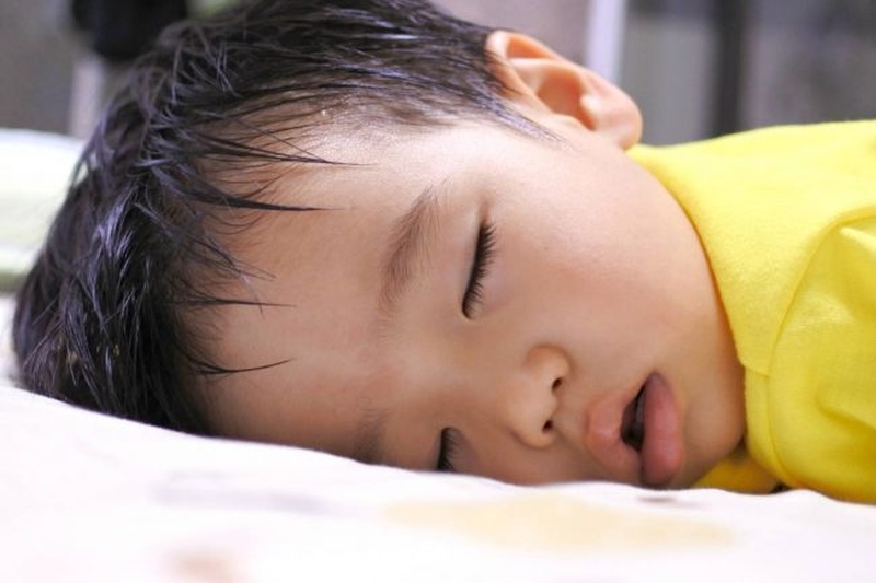 Nóng và mồ hôi có thể làm triệu chứng chàm ở trẻ trở nên khó chịu hơn