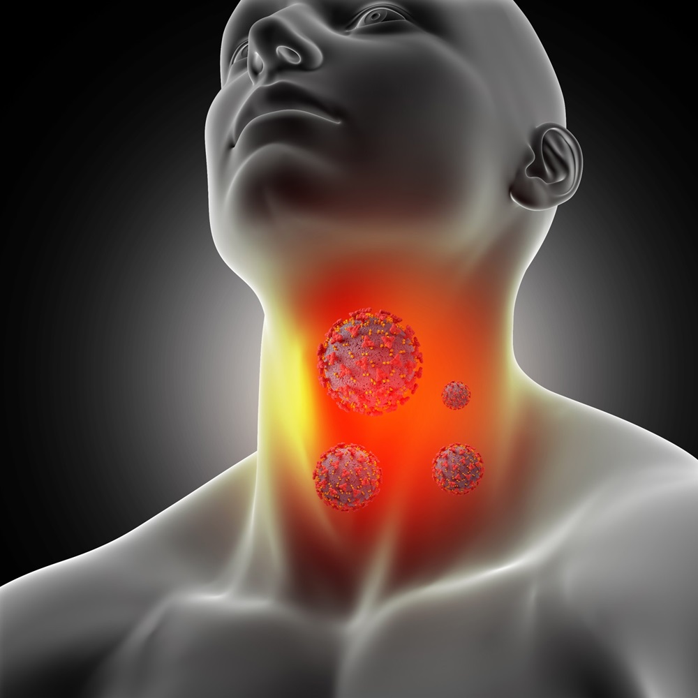 Phân biệt đúng viêm họng do virus và vi khuẩn giúp lựa chọn cách điều trị phù hợp