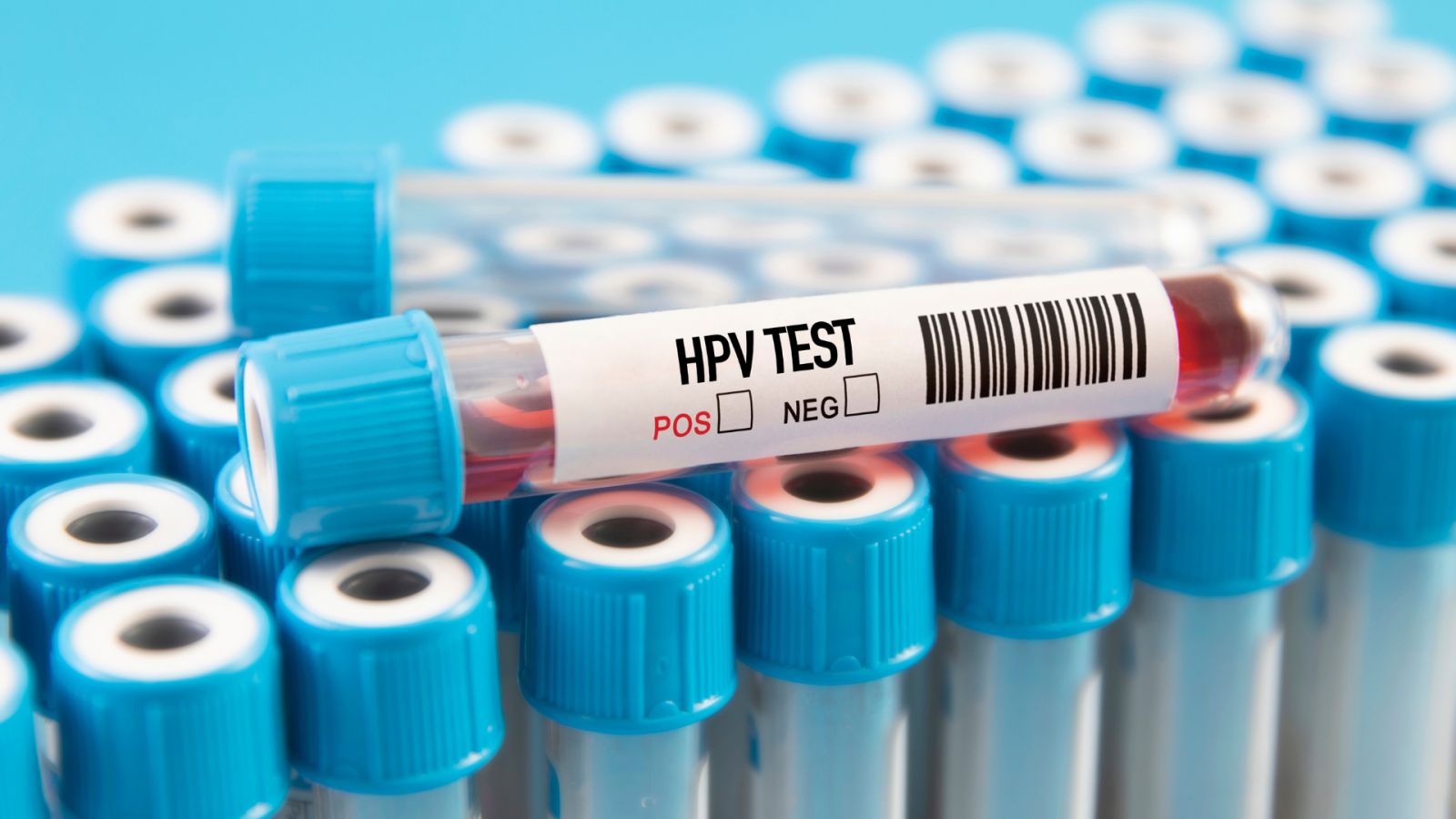 Phụ nữ đang tầm soát HPV và ung thư cổ tử cung tại bệnh viện