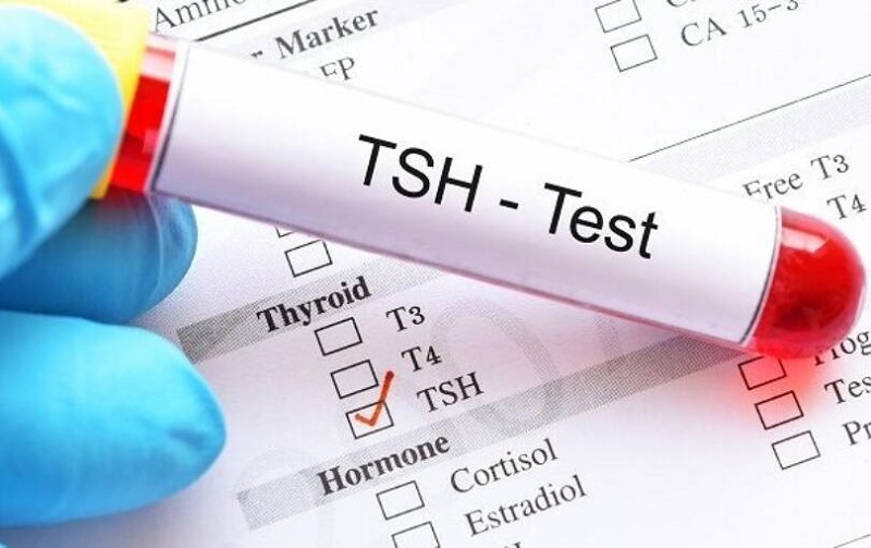 Xét nghiệm máu để biết rối loạn hormone